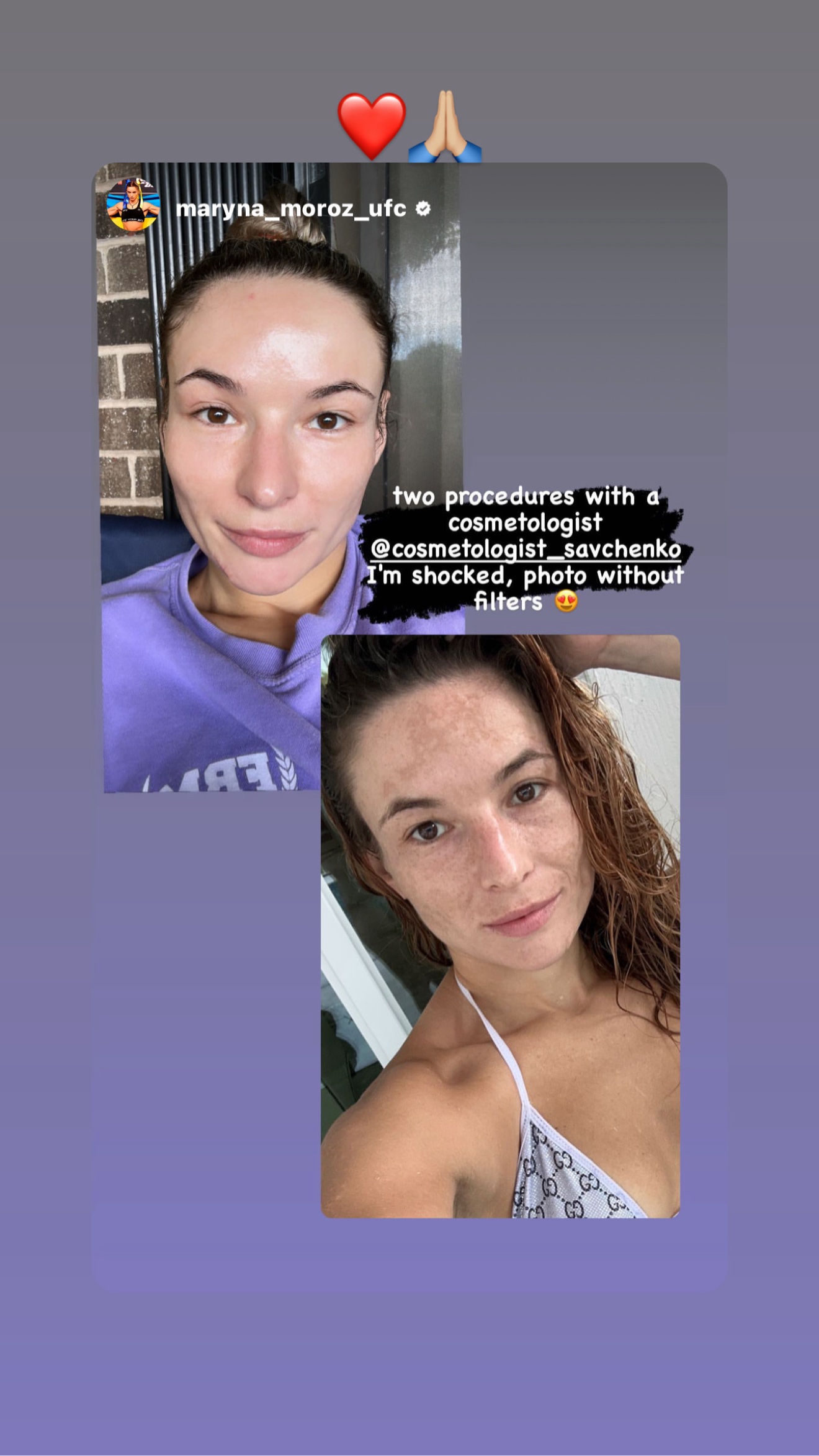 Instagram story by UFC fighter Maryna Moroz reviewing Maryna Savchenko treatments
